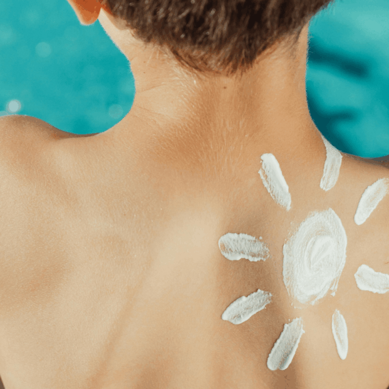 En verano, extrema la protección de tu piel para evitar quemaduras y daños